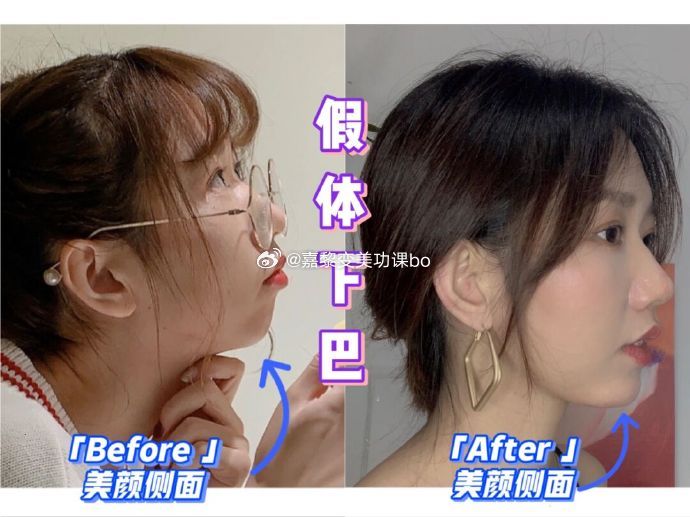 在所有动物中，为什么只有人类拥有下巴？...