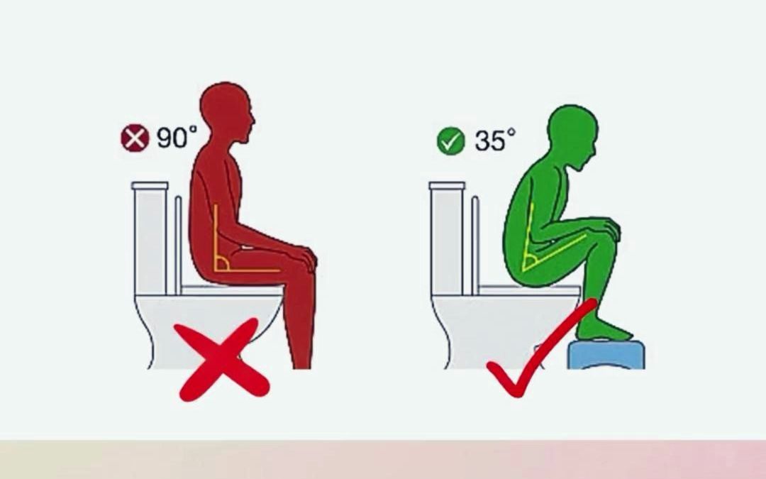 最佳排便姿势怎么选 蹲姿对身体的科学好处