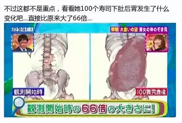 大胃王能吃那么多食物 大胃王的胃有多大