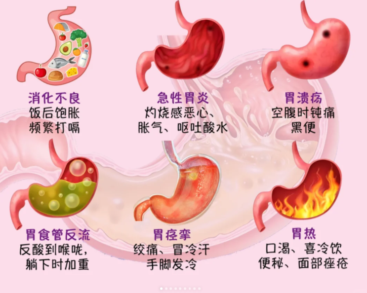 与肠道菌群息息相关的七类病症是什么？如何防治？...