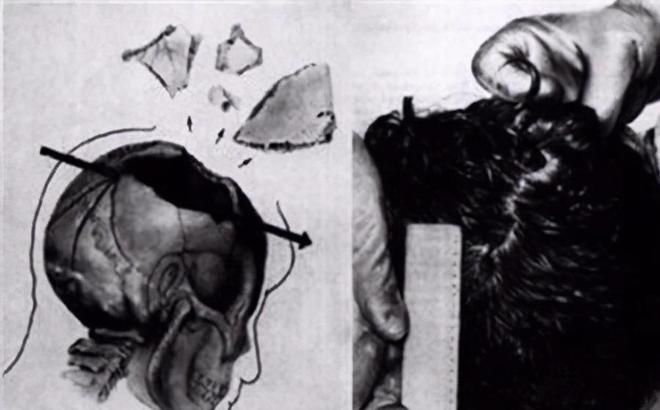 奥斯瓦尔德是凶手吗？肯尼迪遇刺档案解密之路...