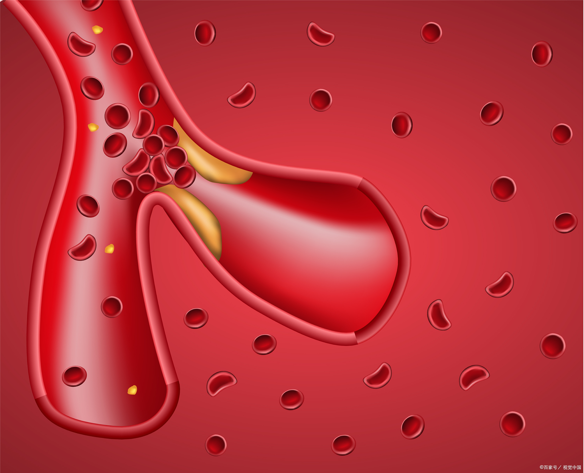 做到这14字，心脑血管病就能远离你？...