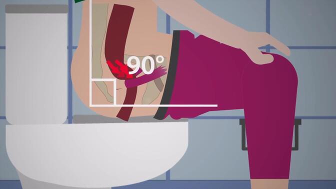 蹲姿排便真治便秘吗？...