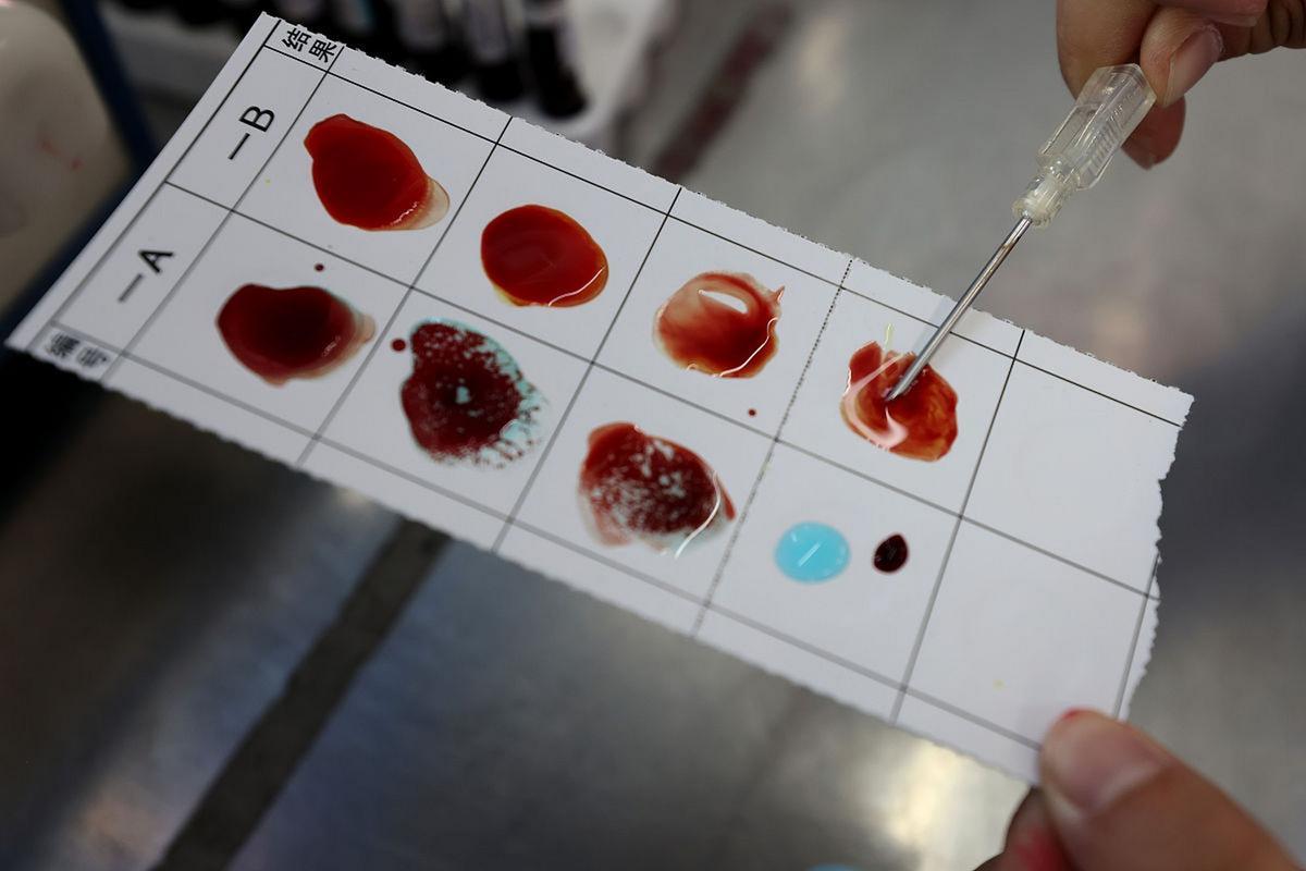 江苏罕见血型 全球仅一例 献血英雄传奇