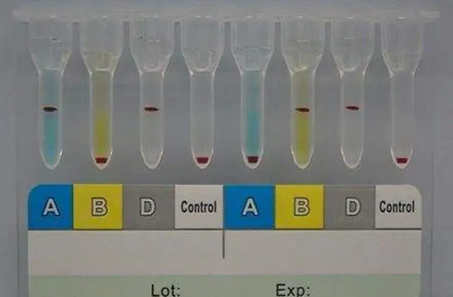 拥有罕见血液,一生献血1173次救百万婴儿,他晚年...