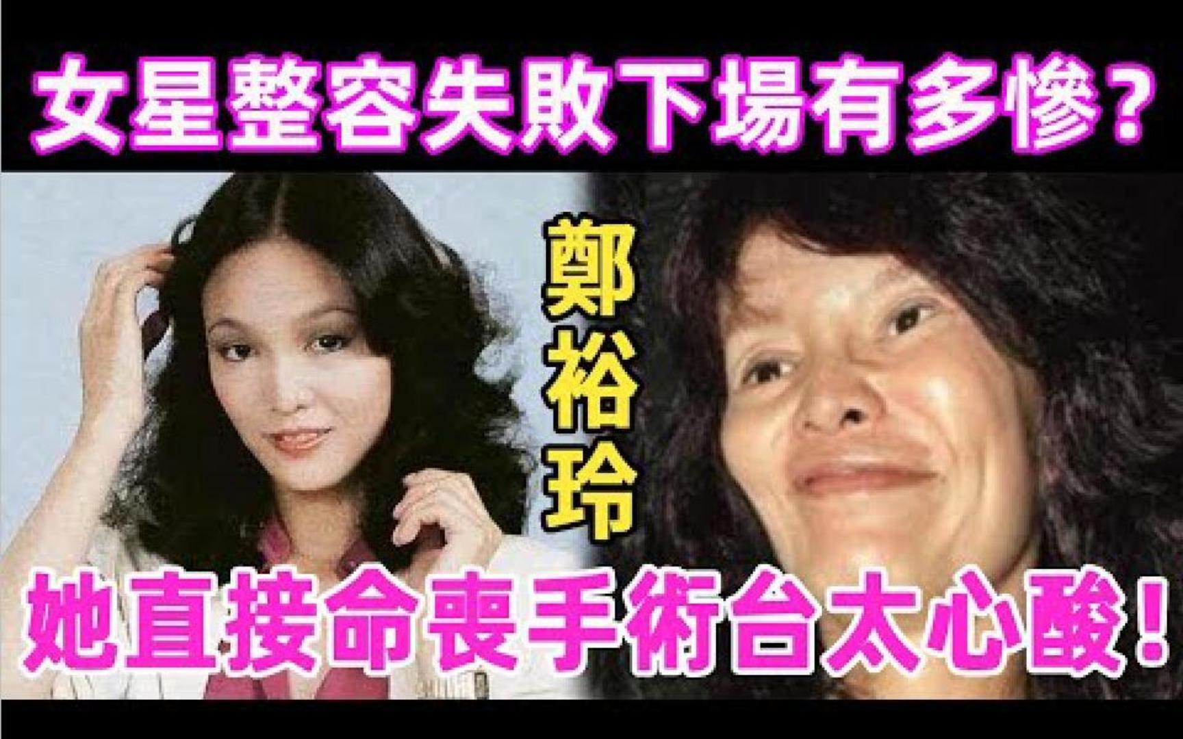 微整形蔚然成风，这样就能成为理想的自己？...